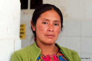 Pacientes en las Obras